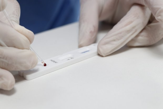 teste_rapido_novo_coronavirus__covid-19_20200504_1524810242.jpeg